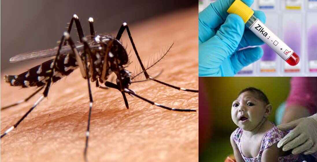 Zika virus | దేశంలో జికా వైరస్ కేసుల కలకలం.. ఈ మహమ్మారికి ఇలా చెక్ పెట్టండి